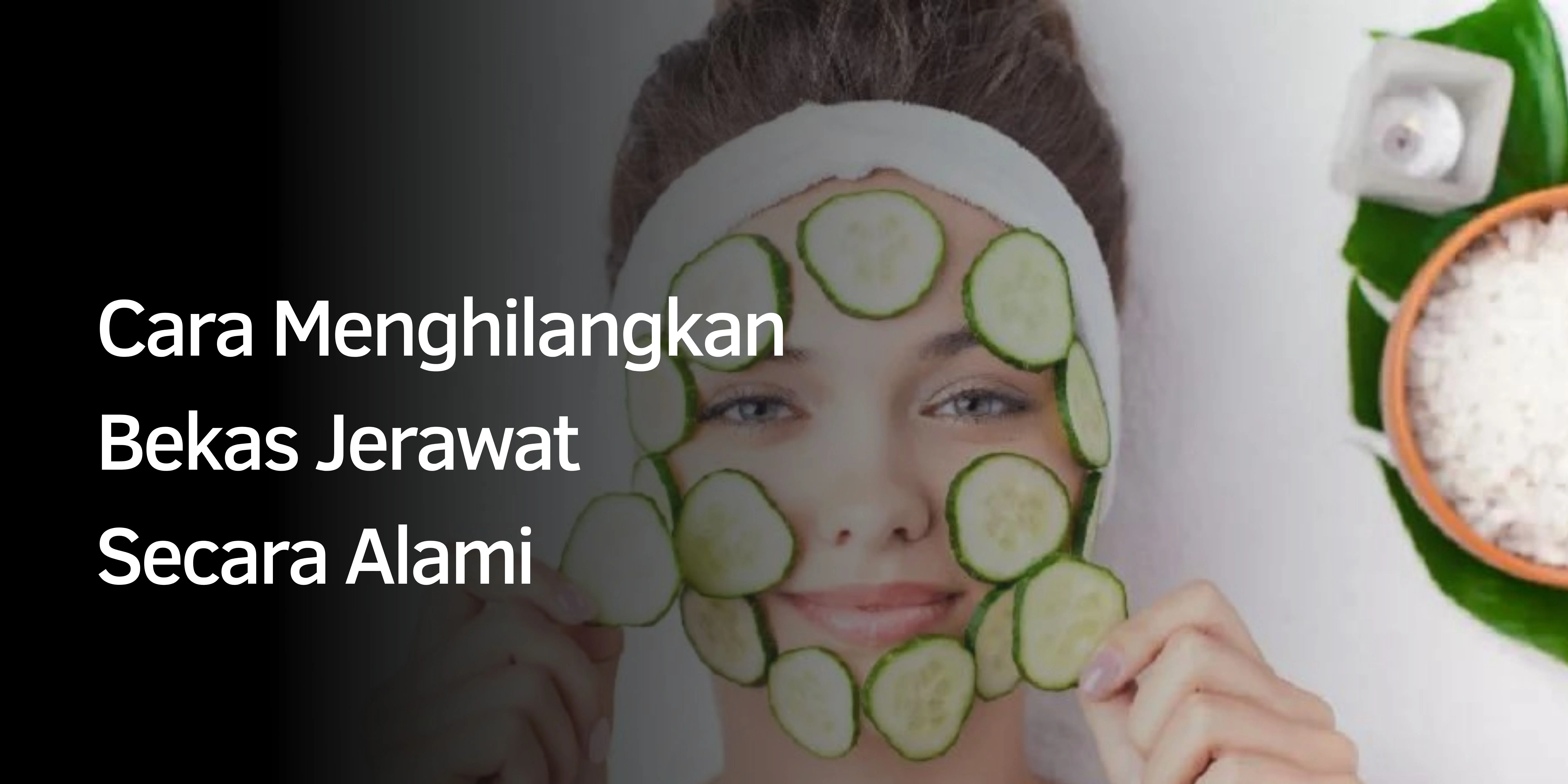 Cara Menghilangkan Jerawat: Tips Ampuh untuk Kulit Bersih dan Bebas Jerawat