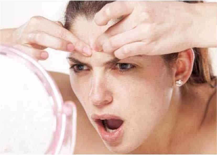 Manfaat Serum Hanasui Anti Acne untuk Kulit Wajah Bebas Jerawat