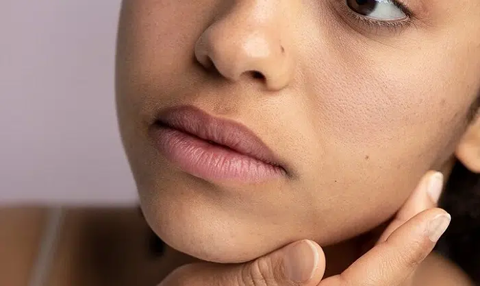 Cara Mengatasi Kulit Kusam Dalam Satu Malam